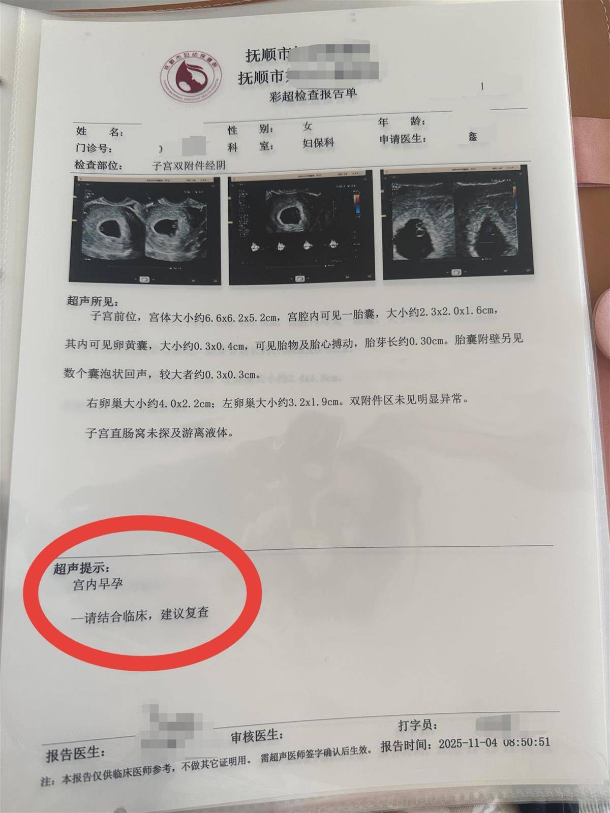 皇冠足球平台
_辽宁一孕妇两个月内从一胎变四胞胎皇冠足球平台
,每次产检发现多出一胎,医生:系同卵四胞胎,概率1300万至1500万分之一